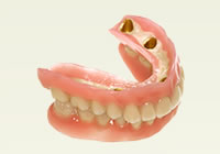 AGC テレスコープ義歯